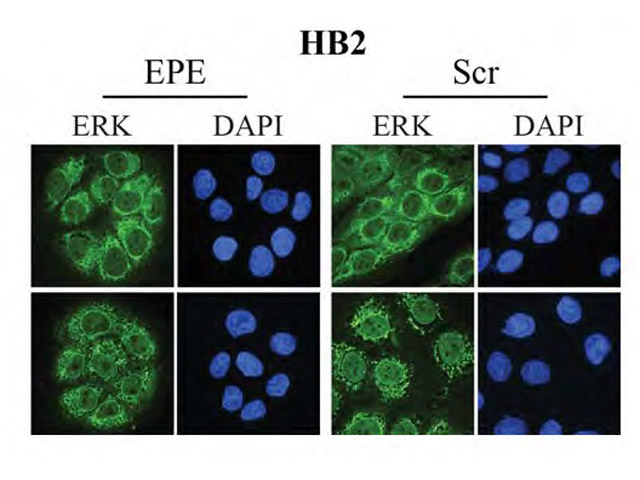 Immortalized cells, left, pretreated with a drug that blocks the ERK signal, and right, without the pretreatment. Top cells are untreated, while the bottom ones are stimulated.