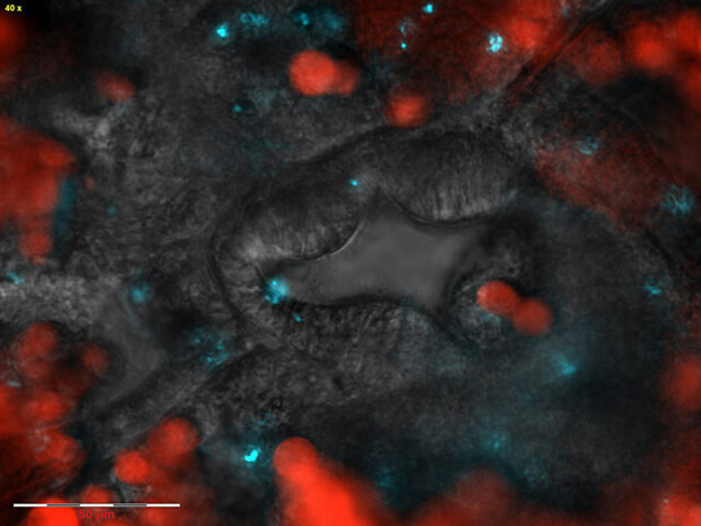 The mouth of a coral polyp: Symbiotic algae are labeled in red, pathogenic bacteria that enter through this region are labeled in blue