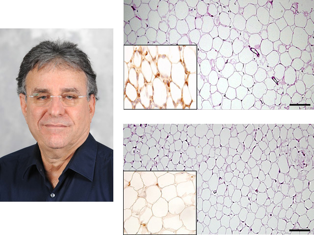 Prof. Yair Reisner - Enlarged fat tissue cells in mice without perforin-rich dendritic cells (above), compared to normal mice tissue (bottom)