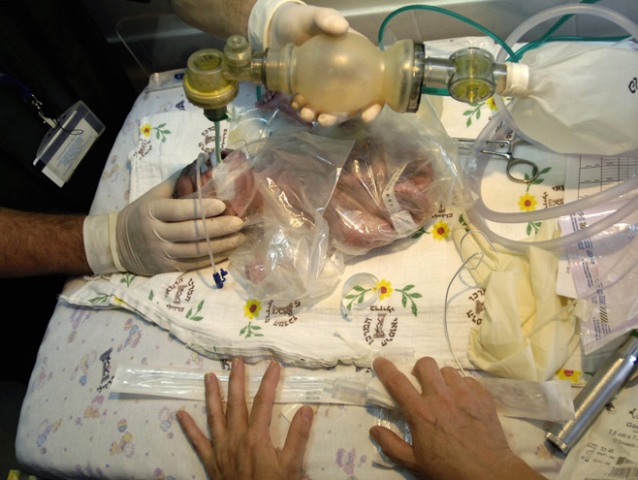 Israeli doctor and nurse tend to one of the quadruplets of a 32 year-old Palestinian from Gaza, delivered at  Barzilai Medical Center in Ashkelon (August 2008)